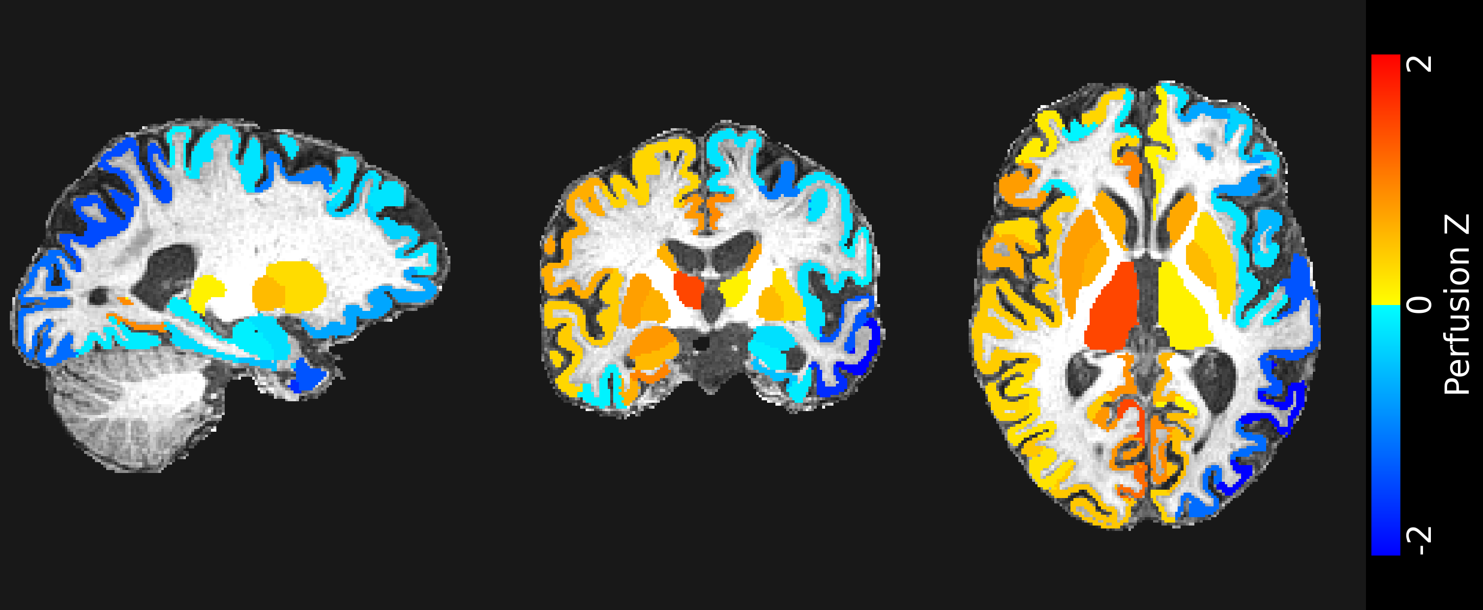 Quantization Radiology Radiology – Quantified Imaging